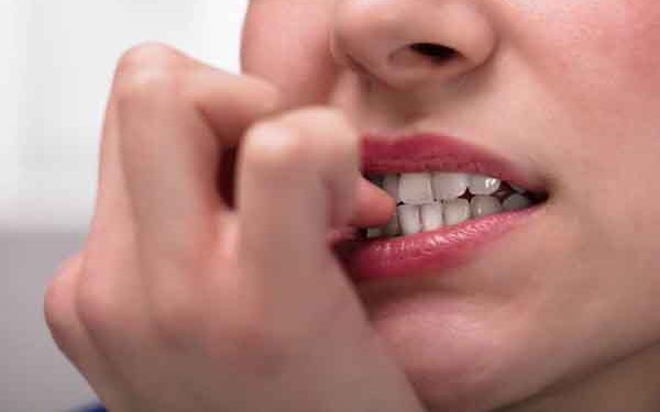 How To Stop Biting Nails – 7 Hacks That Work