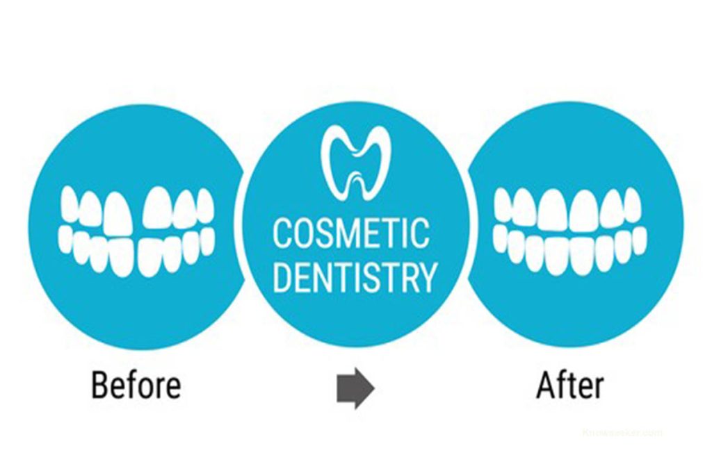 Cosmetic dental procedures to know
