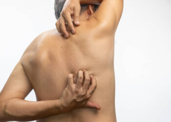 Man itching his skin after a bath