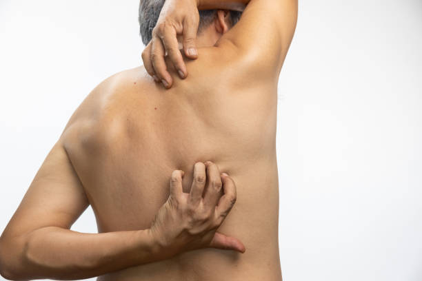 Man itching his skin after a bath