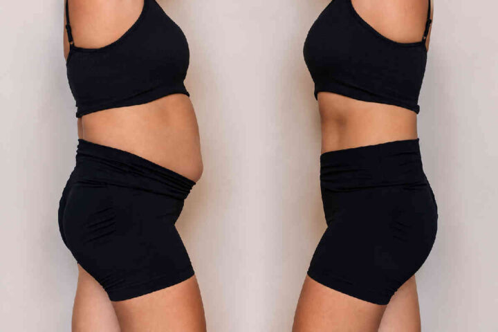 Image of two women, one with more belly fat and the other with flat abdomen