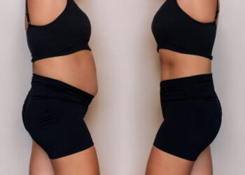 Belly fat before and after